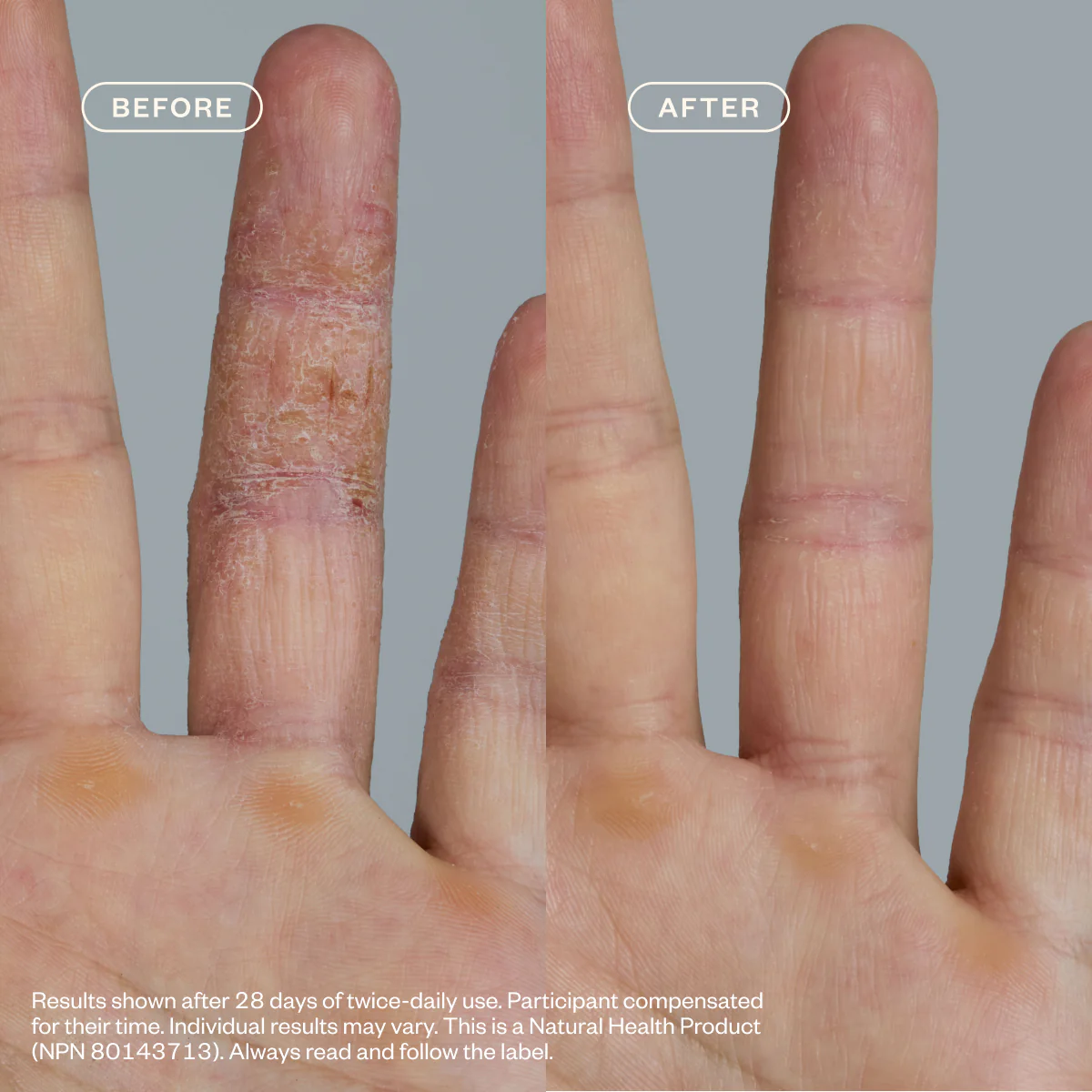 Dermedial Eczema+ - Image 6