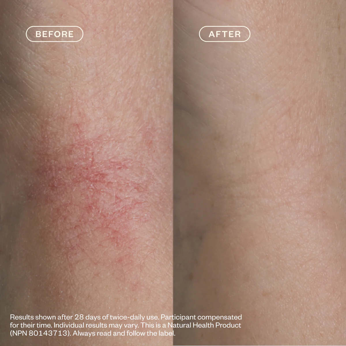 Dermedial™ Relief Duo - Image 6